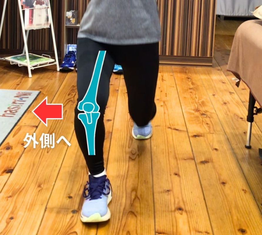 膝が外側へ流れている例