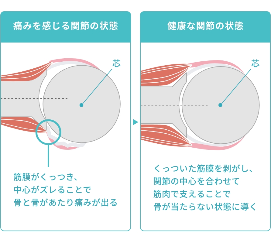痛みを感じる関節の状態：筋膜がくっつき、中心がズレることで骨と骨があたり痛みが出る / 健康な関節の状態：くっついた筋膜を剥がし、 関節の中心を合わせて 筋肉で支えることで 骨が当たらない状態に導く